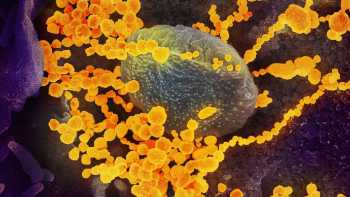 Novel Coronavirus 2019 under a scanning electron microscope